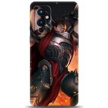 Oneplus 9 Kılıf Hd Baskılı Kılıf - Followed Institution 0185