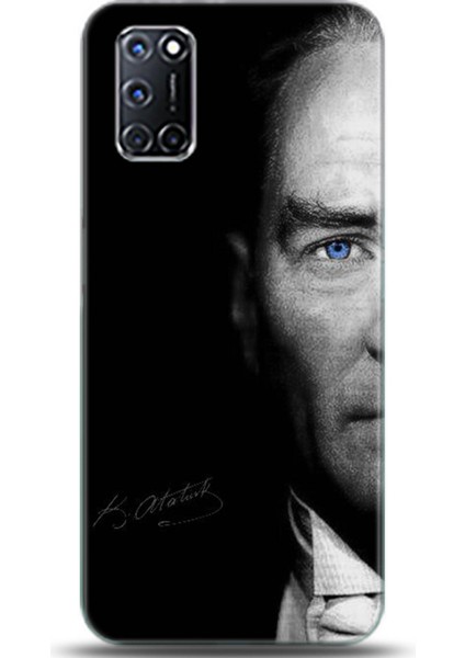 Oppo A52 Kılıf Hd Baskılı Kılıf - Followed Institution 0039