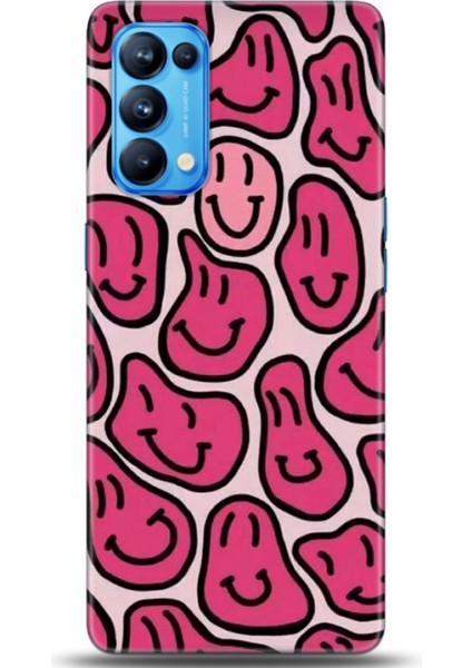 Oppo Reno 5 Pro 5g Kılıf Hd Baskılı Kılıf - Followed Institution 0688