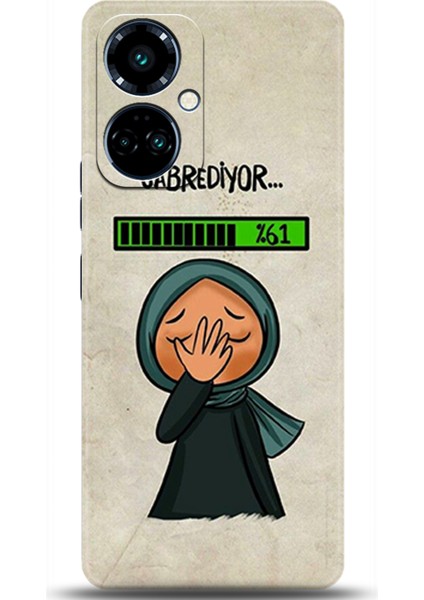 Tecno Camon 19 Pro Kılıf Hd Baskılı Kılıf - Followed Institution 0561