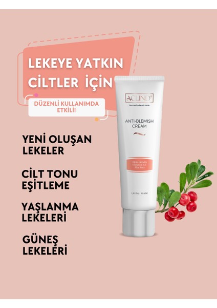 Anti-Blemish Cream - Leke Karşıtı Krem - Güzellik Serisi 30 ml