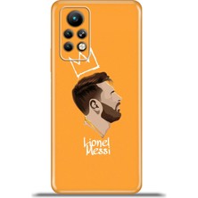 Cupcase Infinix Note 11 Pro Kılıf Esnek Silikon Kamera Koruma 4K Desenli Özel Tasarım - Leomessi