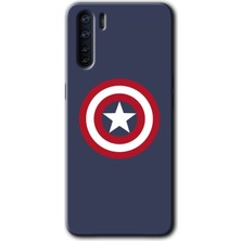 Gramaphone Oppo A91 Kılıf Hd Desen Baskılı Arka Kapak + Kırılmaz Cam - Captain!