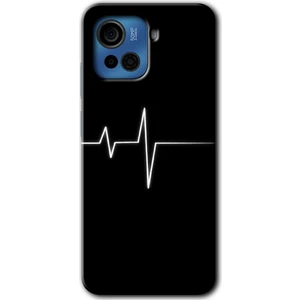 Casper Via F30 Plus Kılıf Hd Desen Baskılı Arka Kapak + Kırılmaz Cam - Heart Rytm