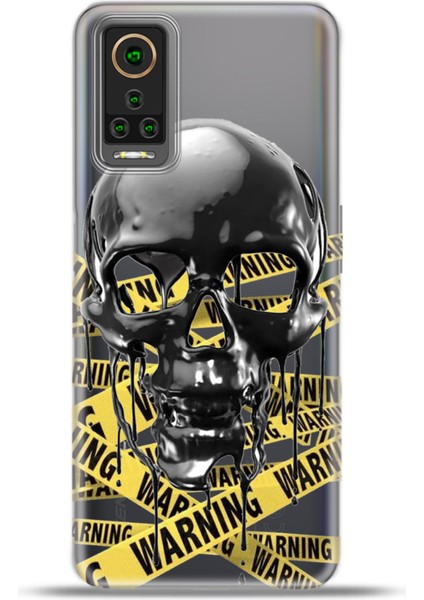 General Mobile Gm 22 Pro Kılıf Esnek Silikon Kamera Koruma 4K Desenli Özel Tasarım - Dangerous