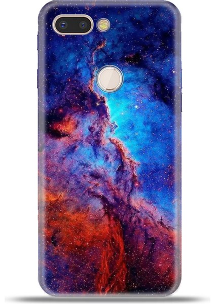 General Mobile Gm9 Pro Kılıf Esnek Silikon Kamera Koruma 4K Desenli Özel Tasarım - Light Year