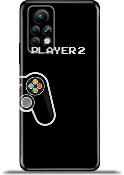 Infinix Note 11 Pro Kılıf Esnek Silikon Kamera Koruma 4K Desenli Özel Tasarım - Player2