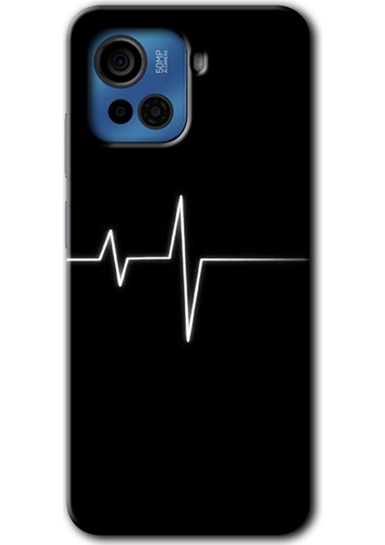 Casper Via F30 Plus Kılıf Hd Desen Baskılı Arka Kapak + Kırılmaz Cam - Heart Rytm