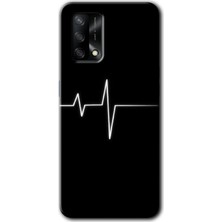 Gramaphone Oppo A54 Kılıf Hd Desen Baskılı Arka Kapak + Kırılmaz Cam - Heart Rytm