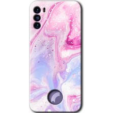 Gramaphone Reeder S19 Max Pro S Kılıf Hd Desen Baskılı Arka Kapak - Kabarmış Leke