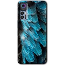 Gramaphone Tcl 30 Kılıf Hd Desen Baskılı Arka Kapak + Kırılmaz Cam - 9d Tüyler