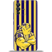 Cupcase Vivo V23 5g Kılıf Esnek Silikon Kamera Koruma 4K Desenli Özel Tasarım -Sarılacivertkanarya