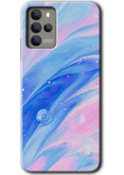 Omix X700 Kılıf Hd Desen Baskılı Arka Kapak + Kırılmaz Cam - Art Design 38