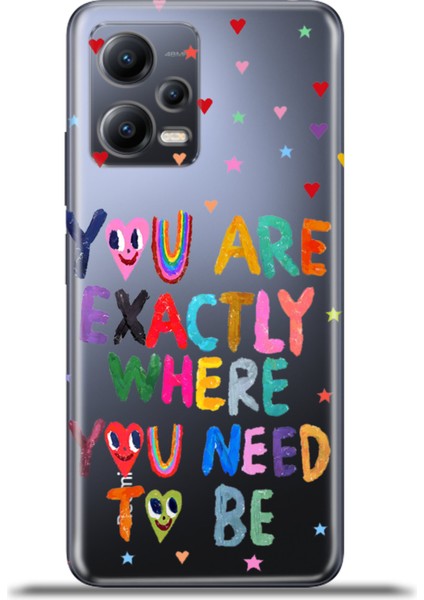 Xiaomi Redmi Note 12 5g Kılıf Esnek Silikon Kamera Koruma 4K Desenli Özel Tasarım - Exactly