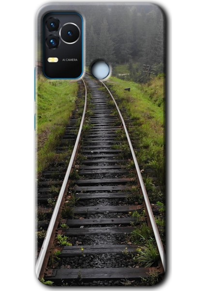Omix X400 Kılıf Hd Desen Baskılı Arka Kapak - Tren Yolu