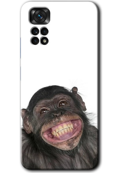 Redmi Note 11S 5g Global Kılıf Hd Desen Baskılı Arka Kapak + Kırılmaz Cam - Şıpsevdi Aşk