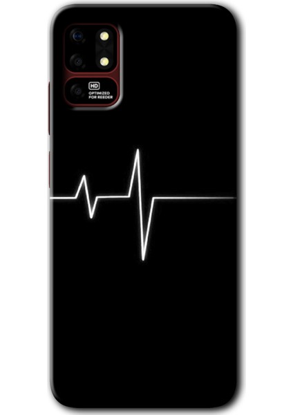 Reeder S19 Max Kılıf Hd Desen Baskılı Arka Kapak + Kırılmaz Cam - Heart Rytm