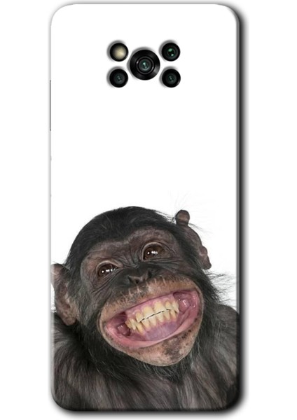 Poco X3 Nfc Kılıf Hd Desen Baskılı Arka Kapak + Kırılmaz Cam - Şıpsevdi Aşk