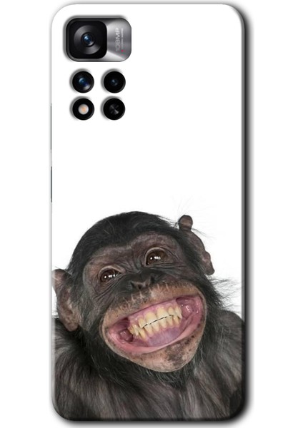 Redmi Note 11 Pro Plus 5g Kılıf Hd Desen Baskılı Arka Kapak - Şıpsevdi Aşk