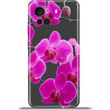 Cupcase Casper Via F30 Kılıf Esnek Silikon Kamera Koruma 4K Desenli Özel Tasarım - Mor Orkide