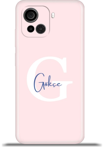 Casper Via F30 Kılıf Silikon Esnek Kamera Koruma Kişiye Özel Isim Harf Zao Pembe - G