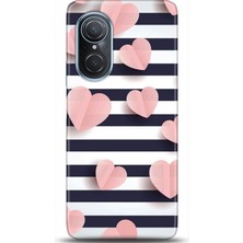 Noprin Huawei Nova 9 Se Kılıf Hd Baskılı Kılıf - Followed Institution 0682