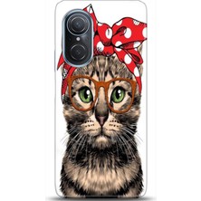 Noprin Huawei Nova 9 Se Kılıf Hd Baskılı Kılıf - Followed Institution 0325
