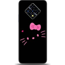Noprin Infinix Zero 8 Kılıf Hd Baskılı Kılıf - Followed Institution 0694
