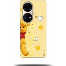 Noprin Huawei P50 Pro Kılıf Hd Baskılı Kılıf - Followed Institution 0609