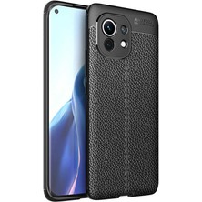 Prolysus Xiaomi Mi 11 Kılıf Deri Desenli En Kaliteli Silikon Kılıf