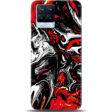 Noprin Realme 8 Pro Kılıf Hd Baskılı Kılıf - Followed Institution 0531
