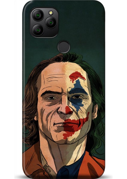 General Mobile Gm 21 Kılıf Hd Baskılı Kılıf - Followed Institution 0441