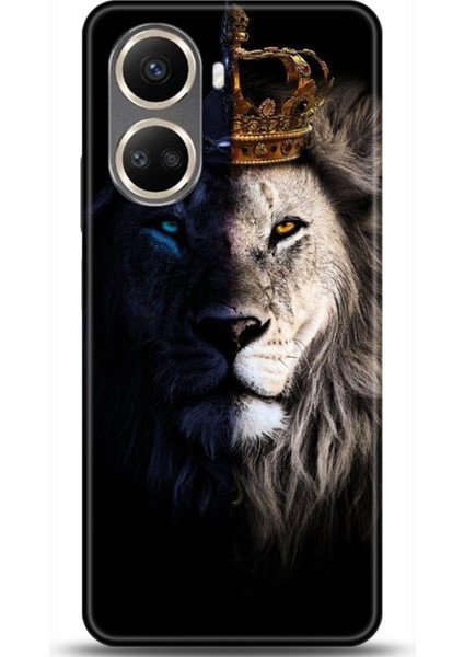 Huawei Nova 10 Se Kılıf Hd Baskılı Kılıf - Followed Institution 0534