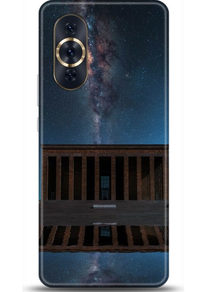 Huawei Nova 10 Pro Kılıf Hd Baskılı Kılıf - Followed Institution 0652