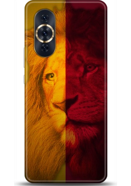 Huawei Nova 10 Pro Kılıf Hd Baskılı Kılıf - Followed Institution 0576