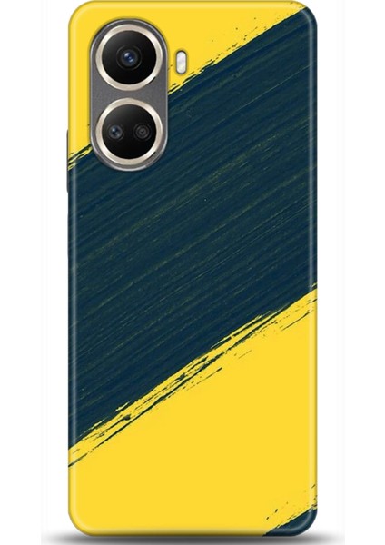 Huawei Nova 10 Se Kılıf Hd Baskılı Kılıf - Followed Institution 0542