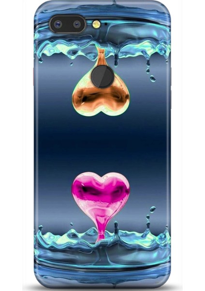 General Mobile Gm9 Pro Kılıf Hd Baskılı Kılıf - Followed Institution 0628