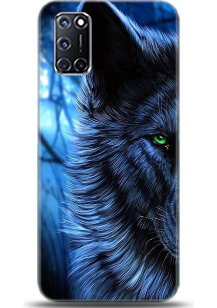 Oppo A72 Kılıf Hd Baskılı Kılıf - Followed Institution 0136