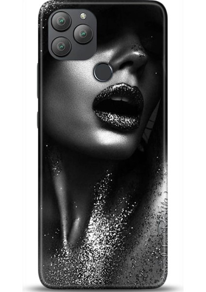 General Mobile Gm 22 Kılıf Hd Baskılı Kılıf - Followed Institution 0338