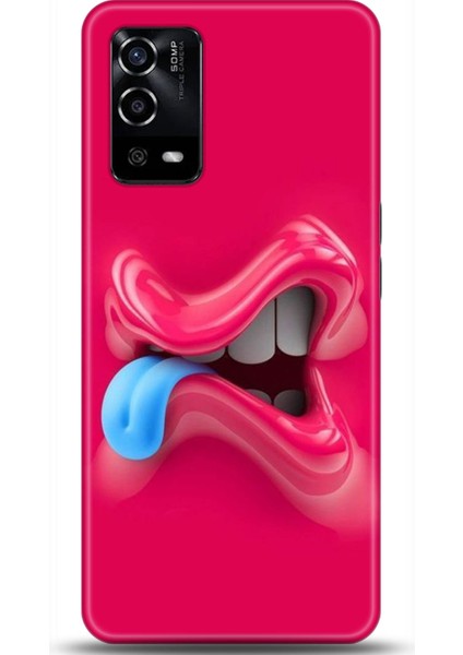 Oppo A55 4g Kılıf Hd Baskılı Kılıf - Followed Institution 0043