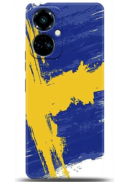 Tecno Camon 19 Pro Kılıf Hd Baskılı Kılıf - Followed Institution 0545