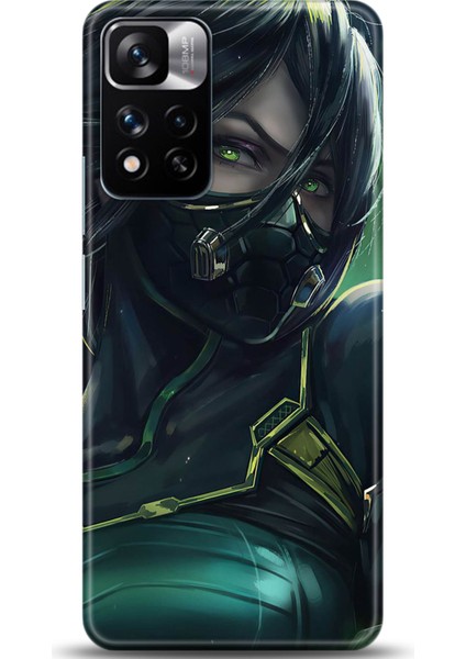 Xiaomi Redmi Note 11 Pro Plus 5g Kılıf Hd Baskılı Kılıf - Followed Institution 0348