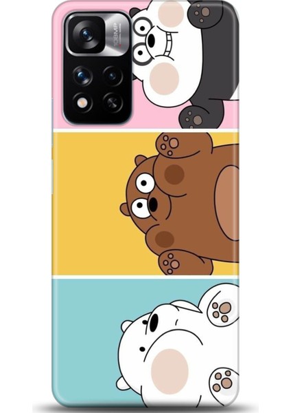 Xiaomi Redmi Note 11 Pro Plus 5g Kılıf Hd Baskılı Kılıf - Followed Institution 0418