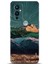 Oneplus 9 Kılıf Hd Baskılı Kılıf - Followed Institution 0332 1