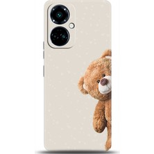 Noprin Tecno Camon 19 Pro Kılıf Hd Baskılı Kılıf - Followed Institution 0005