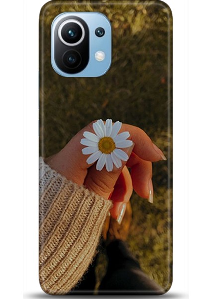 Xiaomi Mi 11 Kılıf Hd Baskılı Kılıf - Followed Institution 0098