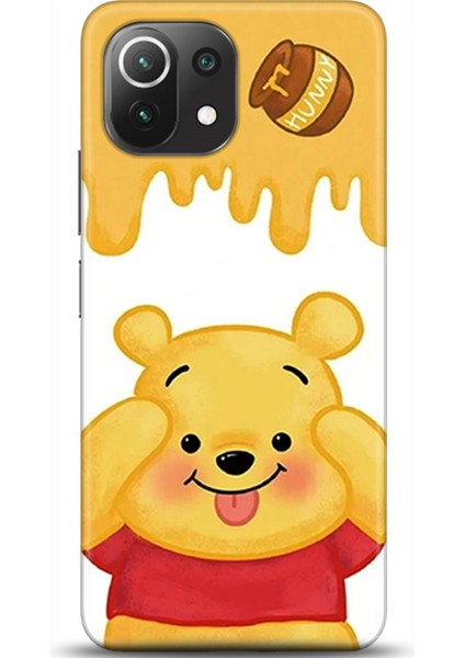 Xiaomi Mi 11 Lite Kılıf Hd Baskılı Kılıf - Followed Institution 0690