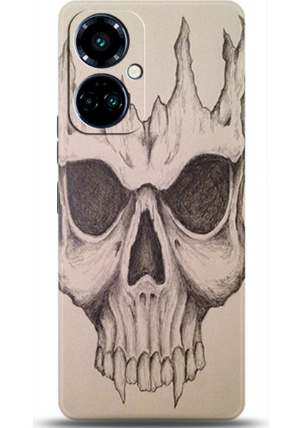 Tecno Camon 19 Pro Kılıf Hd Baskılı Kılıf - Followed Institution 0129