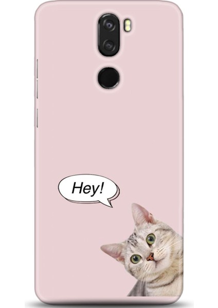 Vestel Venüs Z30 Kılıf Hd Baskılı Kılıf - Followed Institution 0647