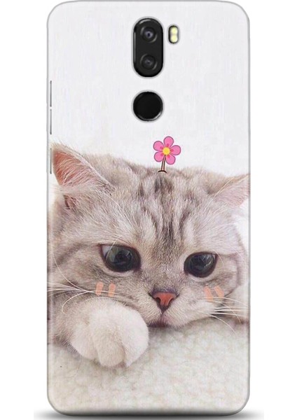 Vestel Venüs Z30 Kılıf Hd Baskılı Kılıf - Followed Institution 0019